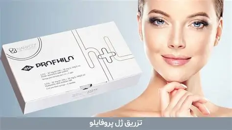 پروفایلو