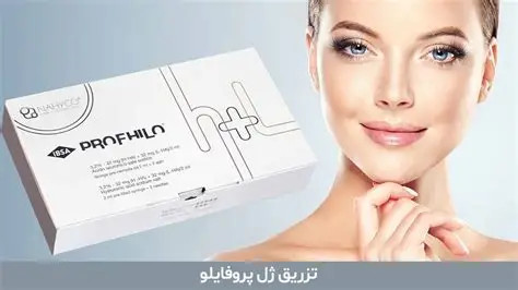 پروفایلو